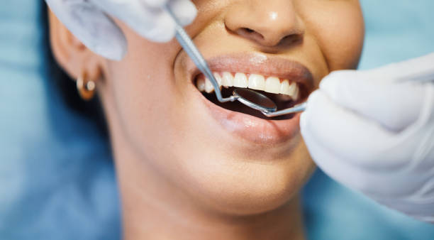 Best Broken or Cracked Tooth Emergency Dentist in Elizabethtown, PA