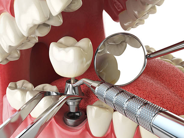 Best Emergency Dentist for Knocked-Out Tooth in Elizabethtown, PA